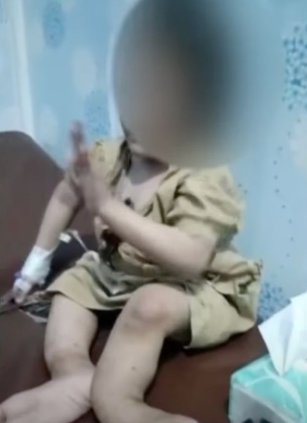 GADIS USIA 10 TAHUN PATAH KAKI DIANIAYA PAMAN SENDIRI DI NIAS SELATAN GADIS USIA 10 TAHUN PATAH KAKI DIANIAYA PAMAN SENDIRI DI NIAS SELATAN