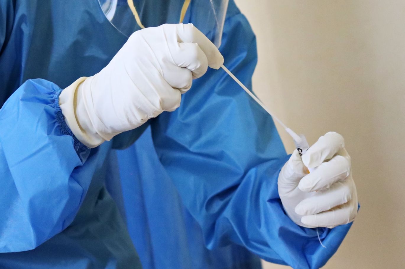 BAGO AT MAPANGANIB SA KALUSUGANG CORONAVIRUS MULA SA PANIKI, NADISKUBRE SA CHINA BAGO AT MAPANGANIB SA KALUSUGANG CORONAVIRUS MULA SA PANIKI, NADISKUBRE SA CHINA